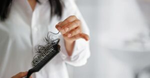 Don’t Let Hair Loss Get You Down